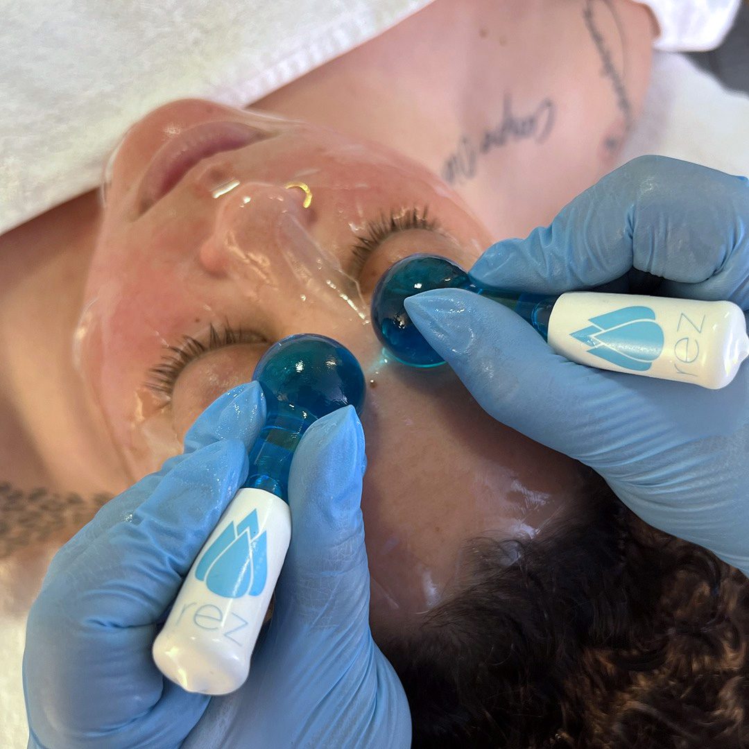 Facial treatment with blue silicone cups on the forehead.