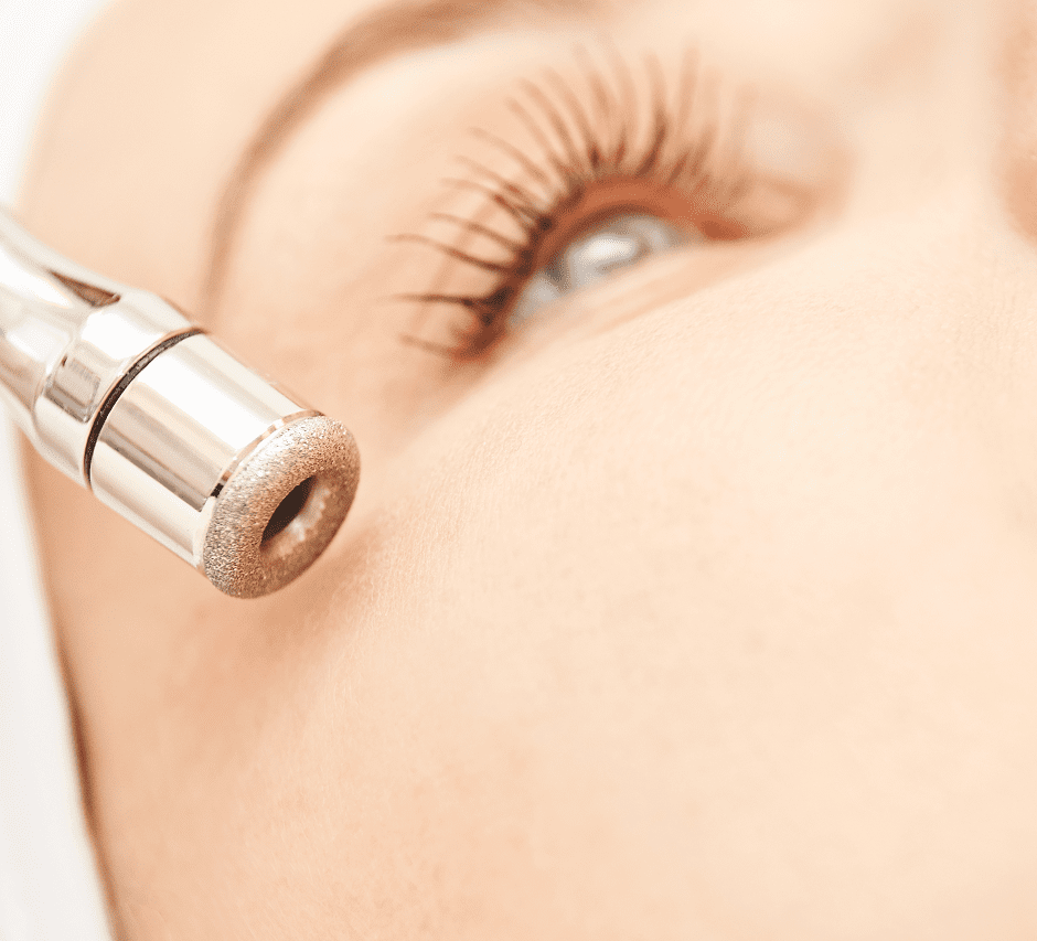 Beauty treatment using microdermabrasion tool